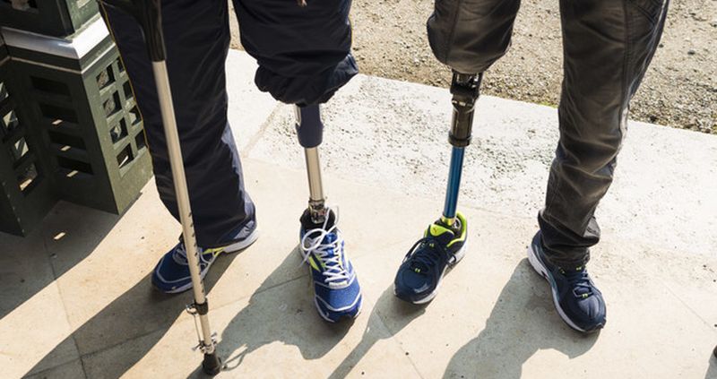 Кабмин уменьшил срок эксплуатации протезов для инвалидов АТО