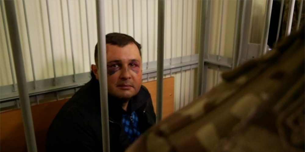 Шепелева привезли в суд с синяками на лице