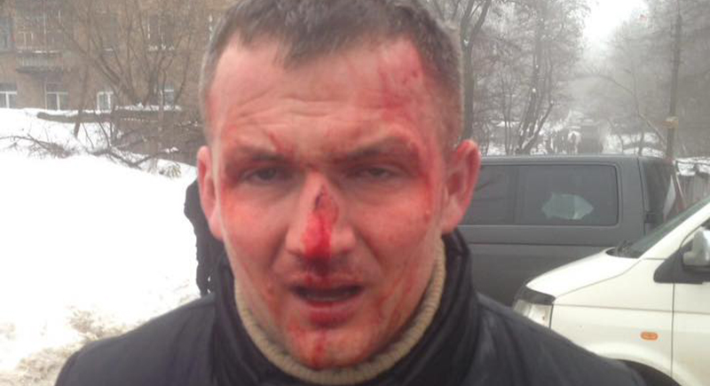 В Киеве избили нардепа Левченко