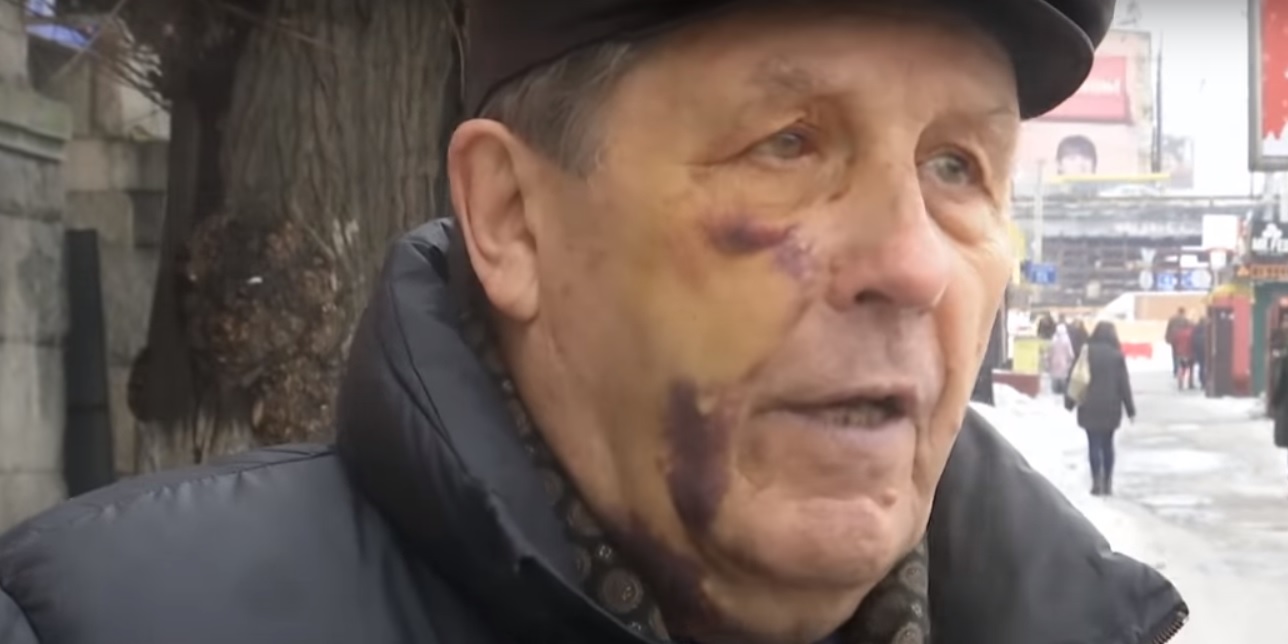 Против полицейских возбудили дело из-за избиения авиаконструктора в Киеве