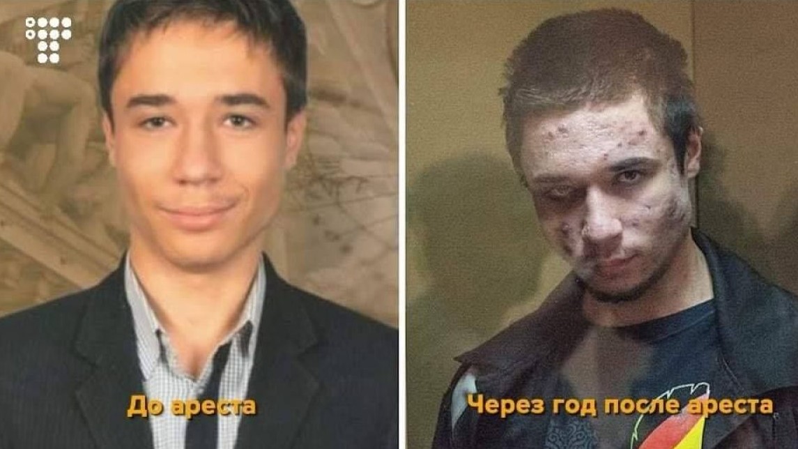 Посол Украины сравнил фото Гриба до и после ареста