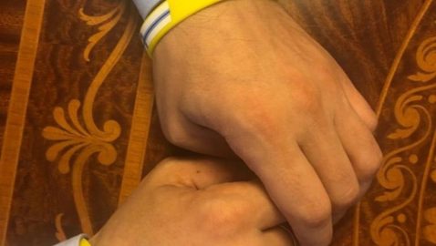 Зеленский объяснил браслеты на руках «из клубов»