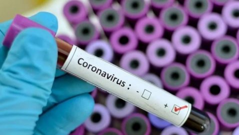 Нардеп заявила, что украинцев будут проверять на коронавирус системами из России