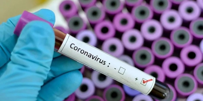 Нардеп заявила, что украинцев будут проверять на коронавирус системами из России