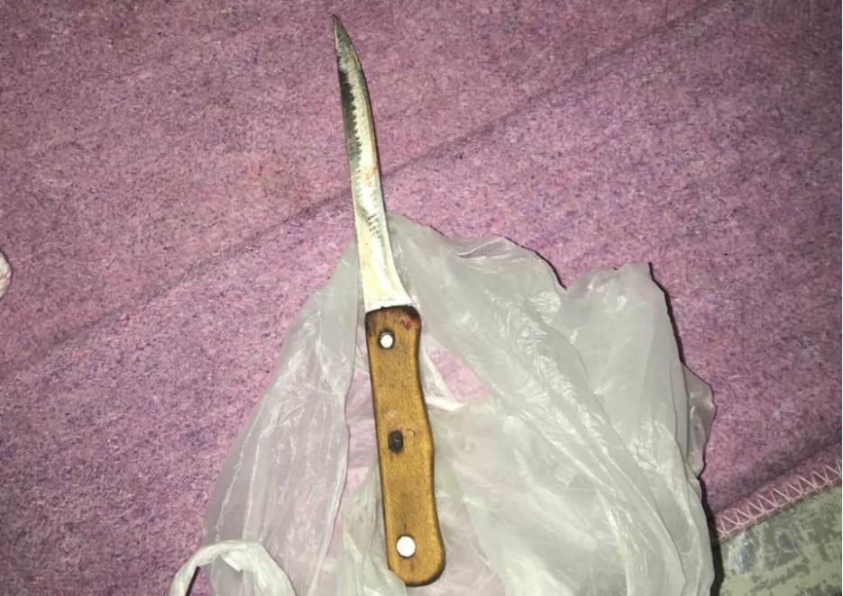 Под Харьковом 7-летняя девочка несколько раз ударила бабушку ножом