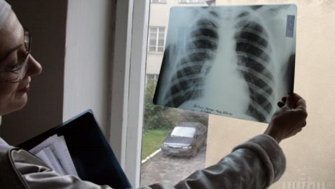 Степанов: второй этап медреформы приведет к росту заболеваемости туберкулезом 30%