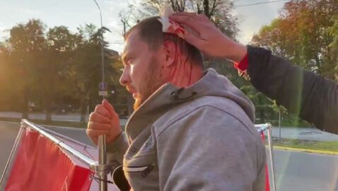 В Кременчуге кандидату от Партии Шария арматурой разбили голову