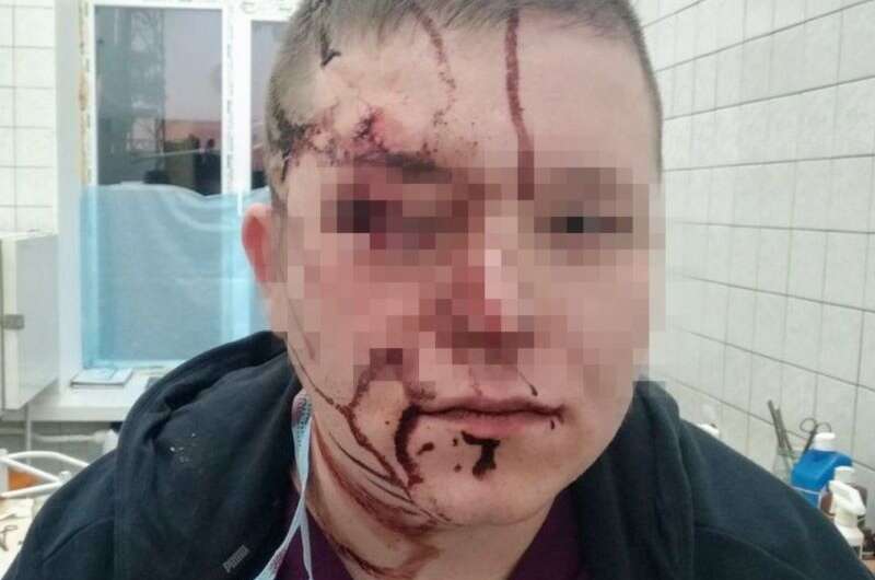 В киевской больнице пациент разбил стулом голову врачу