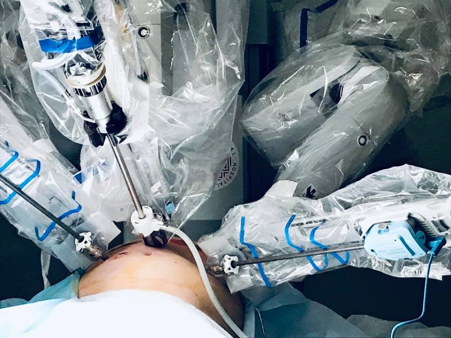 Во Львове робот-хирург Da Vinci прооперировал первого пациента