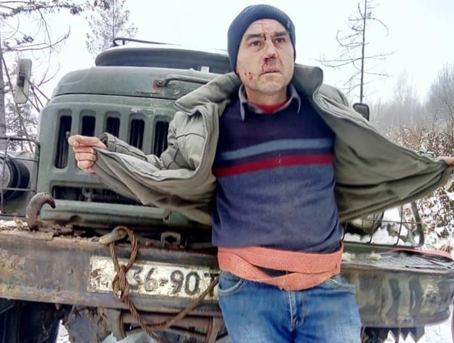 На Львовщине журналиста избили, привязали к лесовозу и тащили по земле