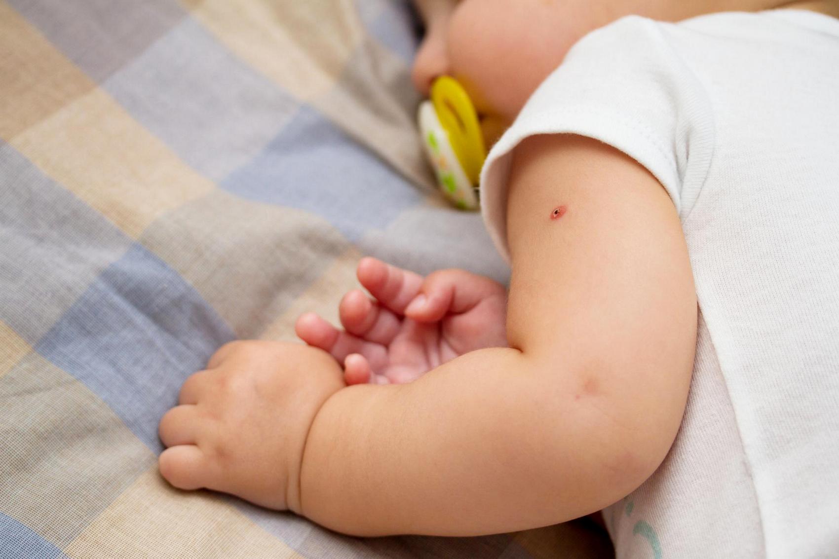 В Украине закончилась вакцина от туберкулёза: детей из роддомов выписывают без прививки БЦЖ
