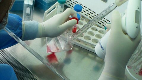 Украинские учёные исследуют эффективность лечения стволовыми клетками пневмонии при COVID-19