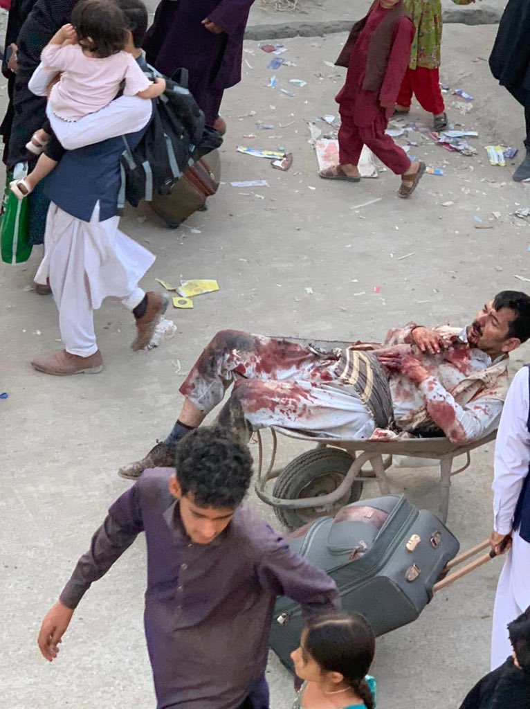 «Руки Джо Байдена в крови»: что известно о взрывах в Кабуле и реакция американских политиков на теракты - 3 - изображение