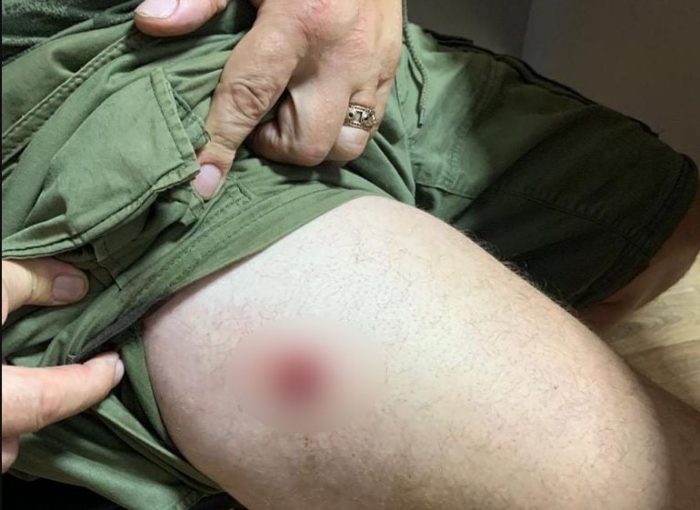 На Киевщине устроили стрельбу из-за места в цирке: есть раненый (фото) - 2 - изображение