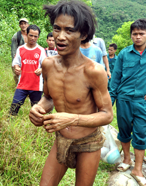 Выросший в джунглях вьетнамец умер от рака после возвращения к людям (фото, видео) - 1 - изображение