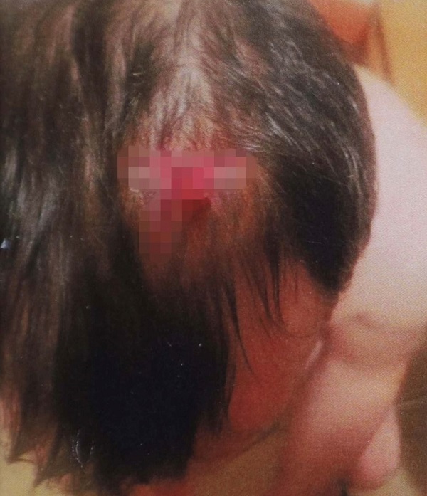 В Киеве полицейские избили мужчину ломом (фото, видео) - 2 - изображение